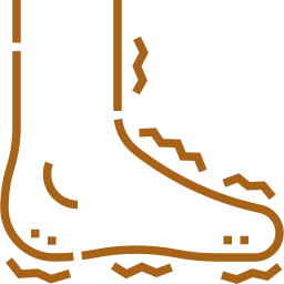 diabetic-neuropathy